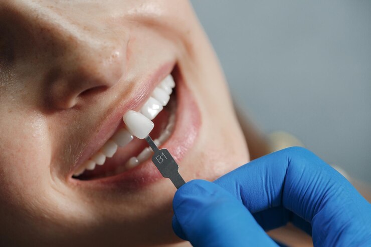 Dental Implants in Naperville, IL Family Dental Clinic